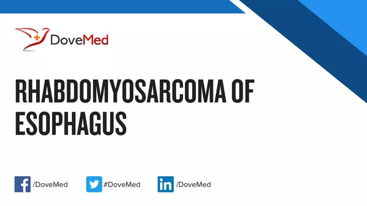 Can you access healthcare professionals in your community to manage Rhabdomyosarcoma of Esophagus?