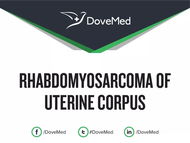 Is the cost to manage Rhabdomyosarcoma of Uterine Corpus in your community affordable?