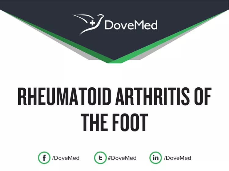 Is the cost to manage Rheumatoid Arthritis of the Foot in your community affordable?