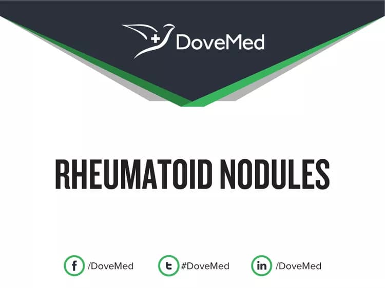 Can you access healthcare professionals in your community to manage Rheumatoid Nodules?