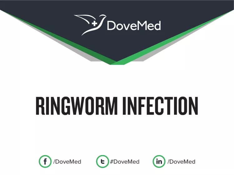 Can you access healthcare professionals in your community to manage Ringworm Infection?