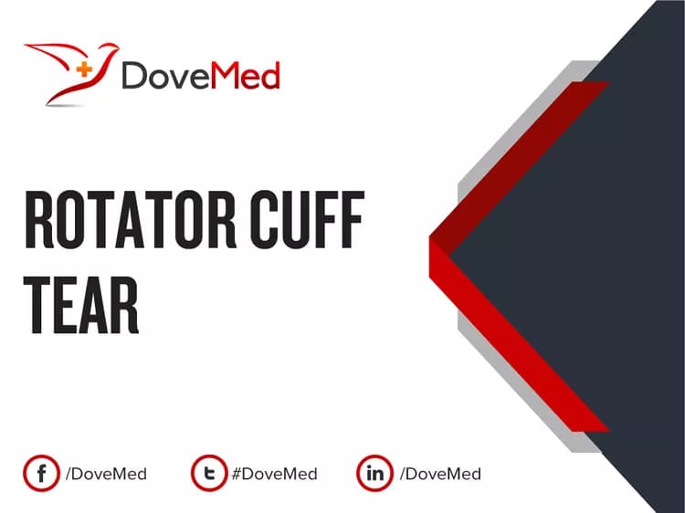 Can you access healthcare professionals in your community to manage Rotator Cuff Tear (RCT)?