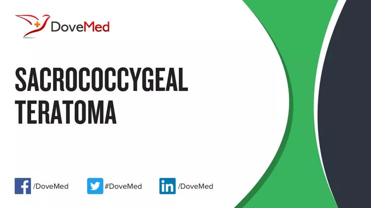 Can you access healthcare professionals in your community to manage Sacrococcygeal Teratoma?