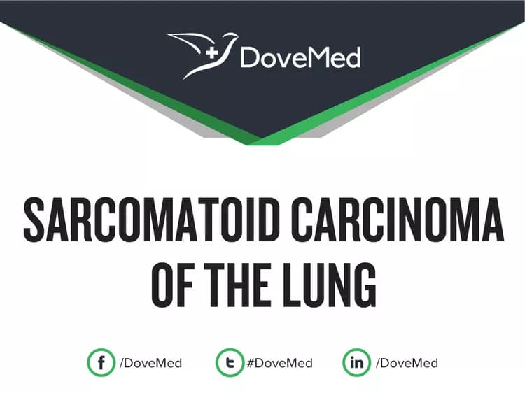 Can you access healthcare professionals in your community to manage Sarcomatoid Carcinoma of the Lung?