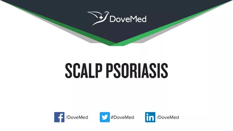 Permanent hair loss is very commonly observed with Scalp Psoriasis.