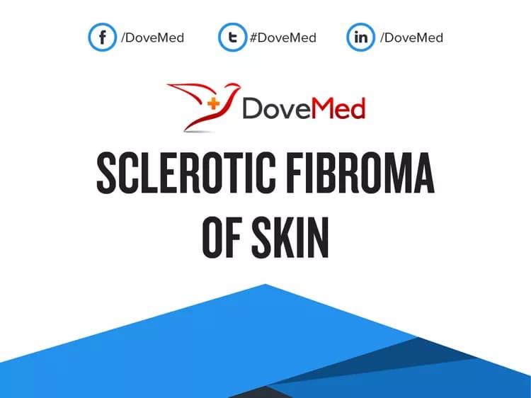 Can you access healthcare professionals in your community to manage Sclerotic Fibroma of Skin?