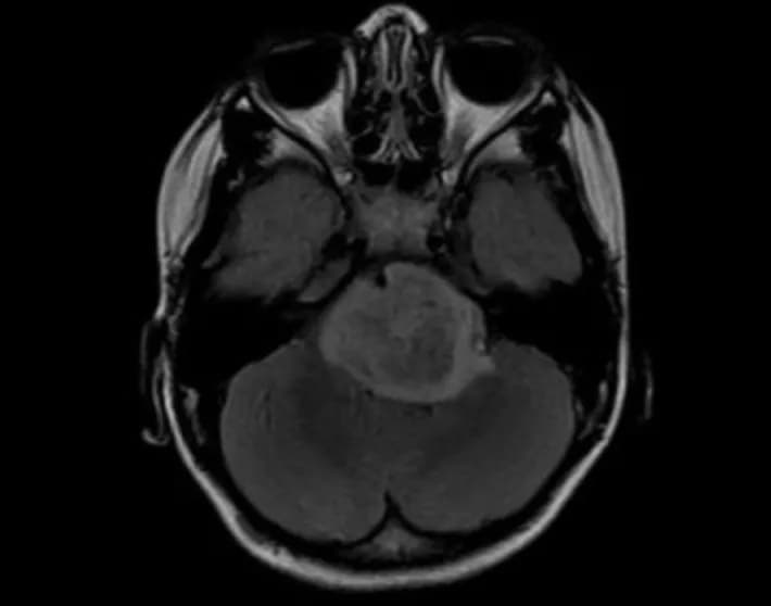 Image courtesy of Michelle Monje, M.D., Ph.D., Stanford University