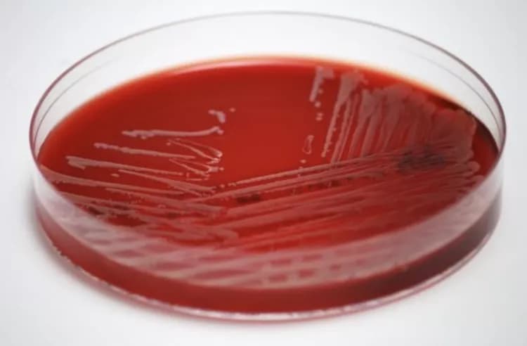 Jesper Smit, MD, PhD