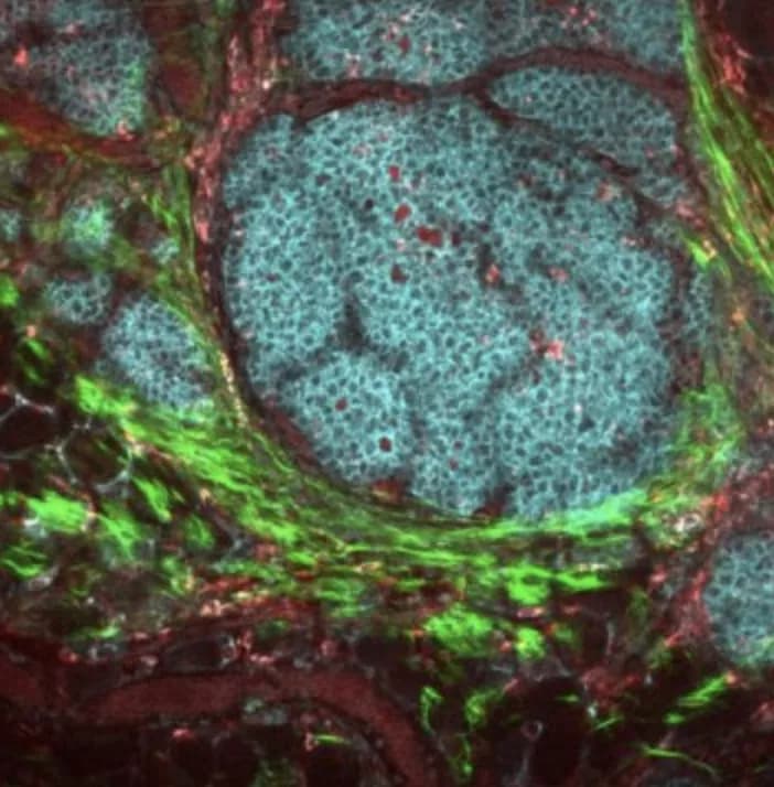 National Cancer Institute