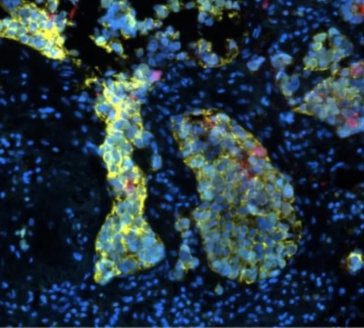 University of Leicester