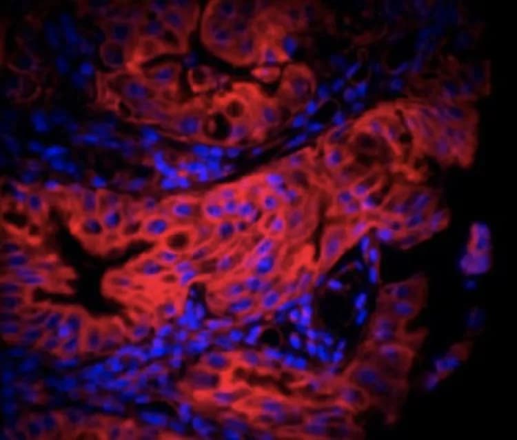 © Laurent Chatre - CNRS/Institut Pasteur