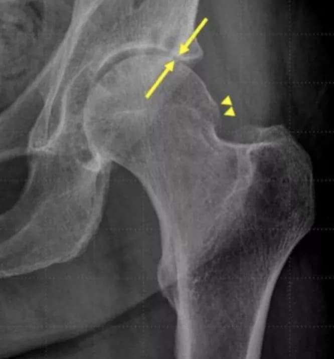 Radiological Society of North America