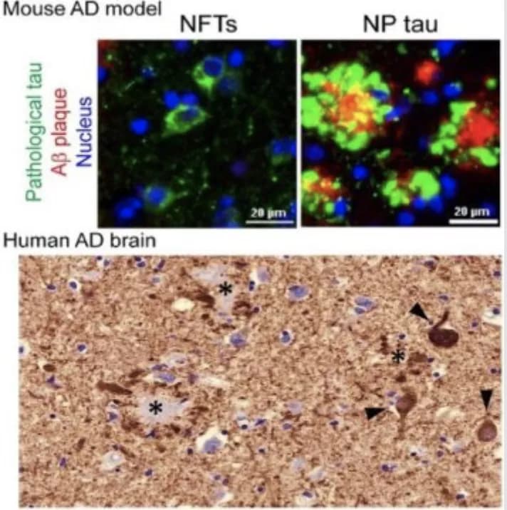 The lab of Virginia Lee, PhD, Perelman School of Medicine, University of Pennsylvania