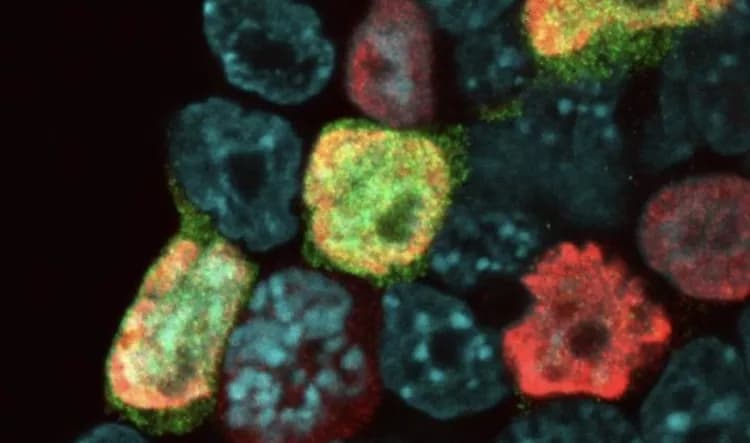 Helmholtz Zentrum München/IES