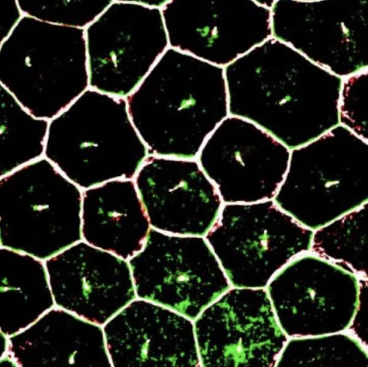 Ruchi Sharma, Ph.D., NEI