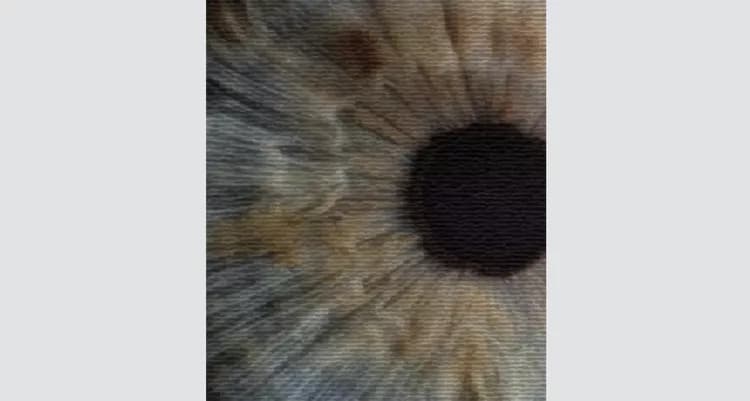 Image courtesy of Daniel Kermany, Guangzhou Medical University and Kang Zhang, UC San Diego Health