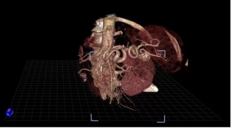 Image courtesy of Society of Interventional Radiology