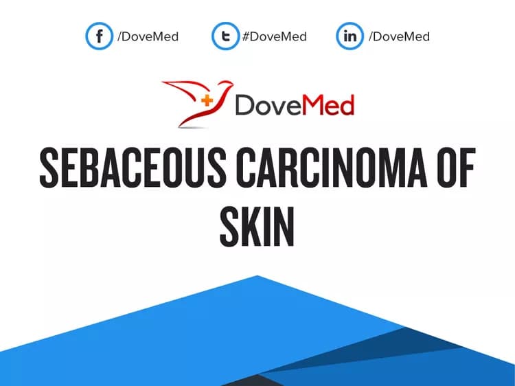 Can you access healthcare professionals in your community to manage Sebaceous Carcinoma of Skin?