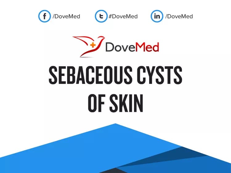 Can you access healthcare professionals in your community to manage Sebaceous Cysts of Skin?