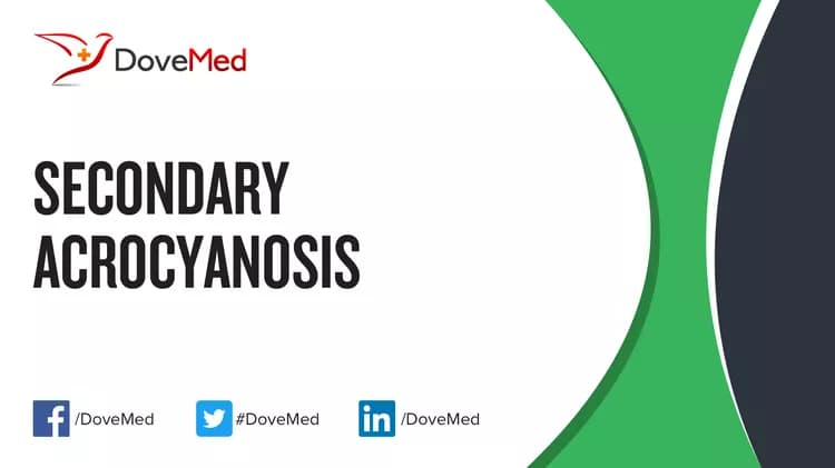 Can you access healthcare professionals in your community to manage Secondary Acrocyanosis?