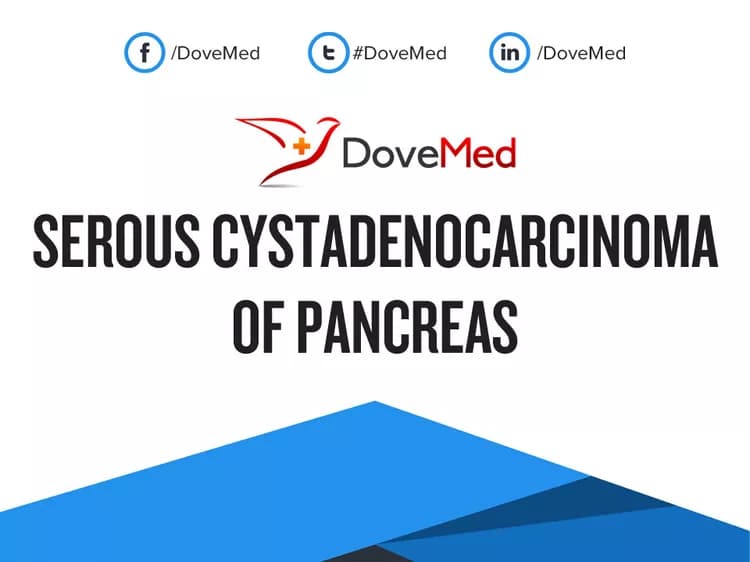 What are the treatment options for Serous Cystadenocarcinoma of Pancreas?