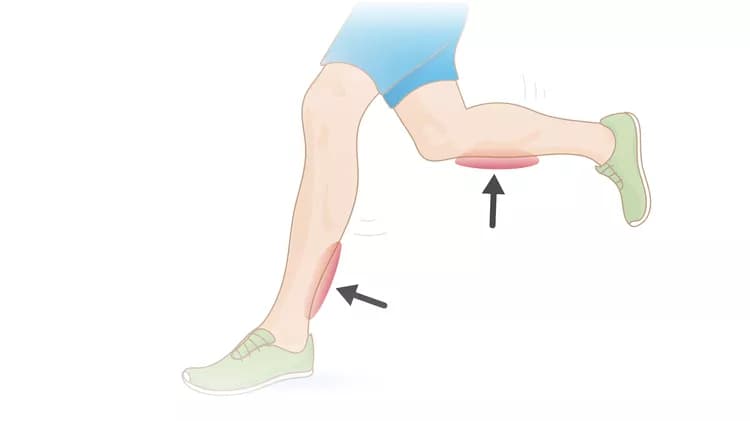 image by InjuryMap - Wikicommons