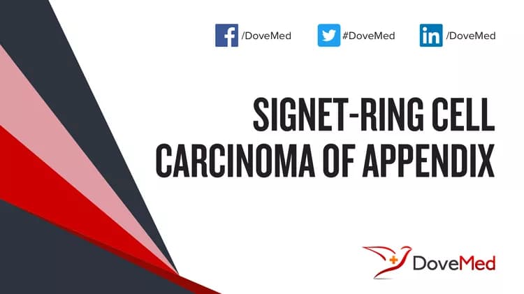 Can you access healthcare professionals in your community to manage Signet-Ring Cell Carcinoma of Appendix?