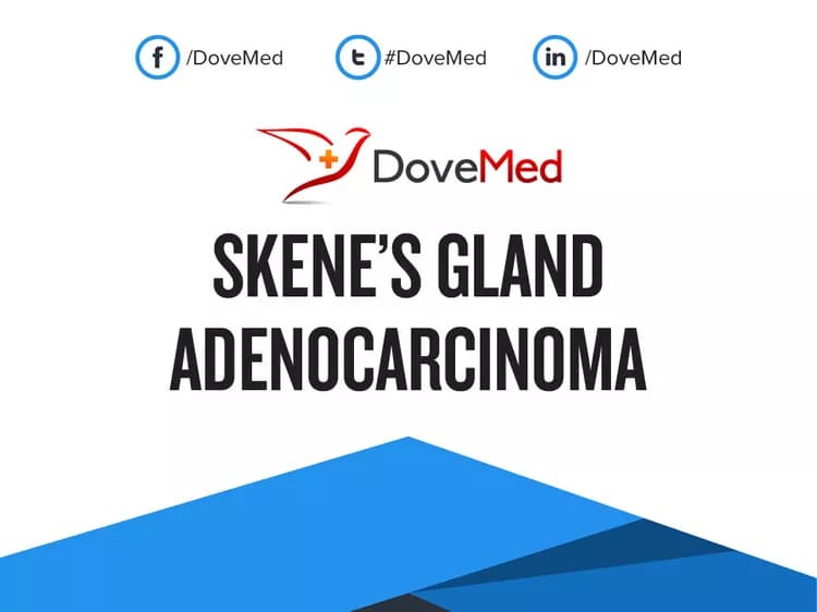 Skene’s Gland Adenocarcinoma