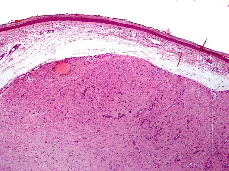 LWozniak&KWZielinski