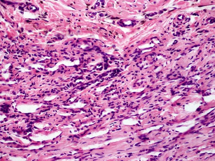 LWozniak&KWZielinski