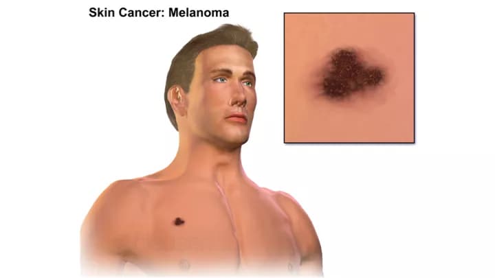 Blausen Medical Communications, Inc.