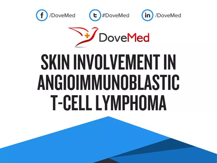 Can you access healthcare professionals in your community to manage Skin Involvement in Angioimmunoblastic T-Cell Lymphoma?