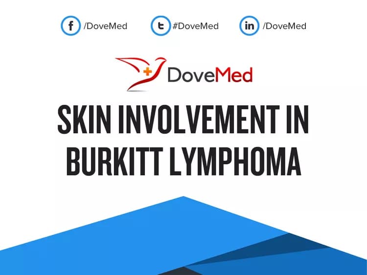 Can you access healthcare professionals in your community to manage Skin Involvement in Burkitt Lymphoma?