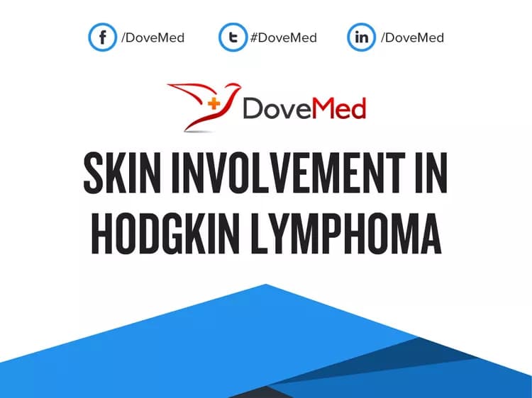Can you access healthcare professionals in your community to manage Skin Involvement in Hodgkin Lymphoma?