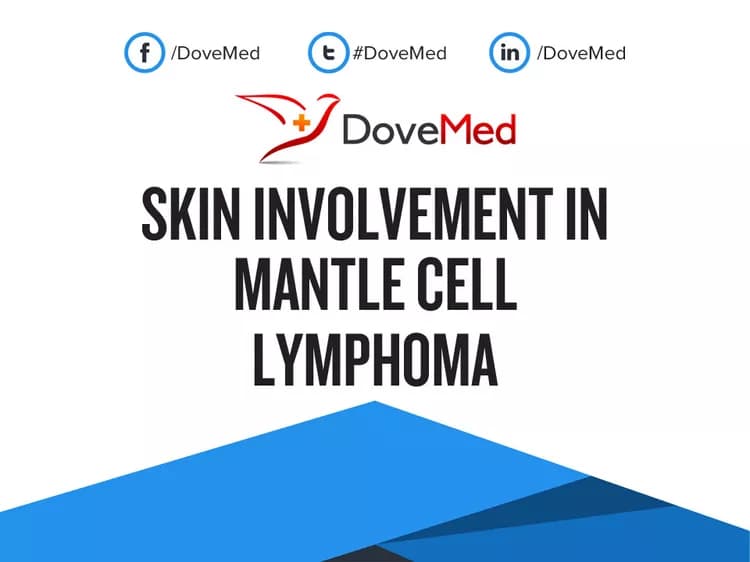 Can you access healthcare professionals in your community to manage Skin Involvement in Mantle Cell Lymphoma?
