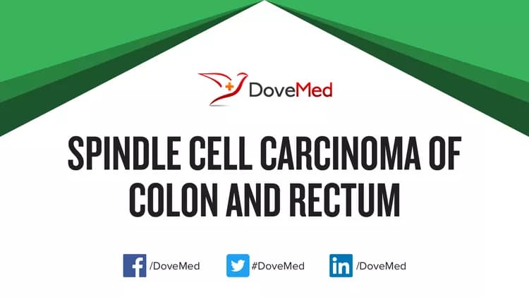 Is the cost to manage Spindle Cell Carcinoma of Colon and Rectum in your community affordable?