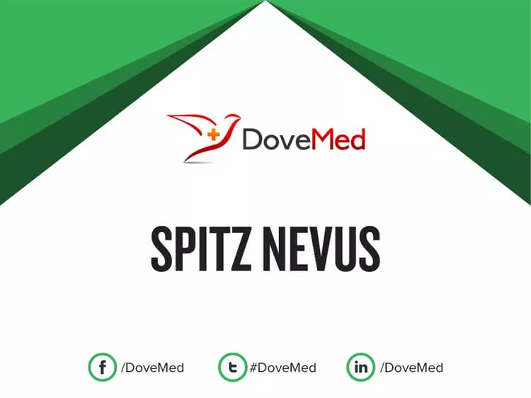 Are you satisfied with the quality of care to manage Spitz Nevus in your community?
