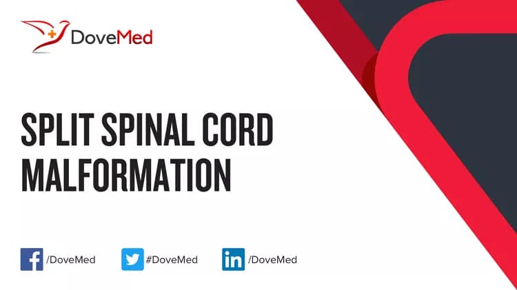 Are you satisfied with the quality of care to manage Split Spinal Cord Malformation in your community?