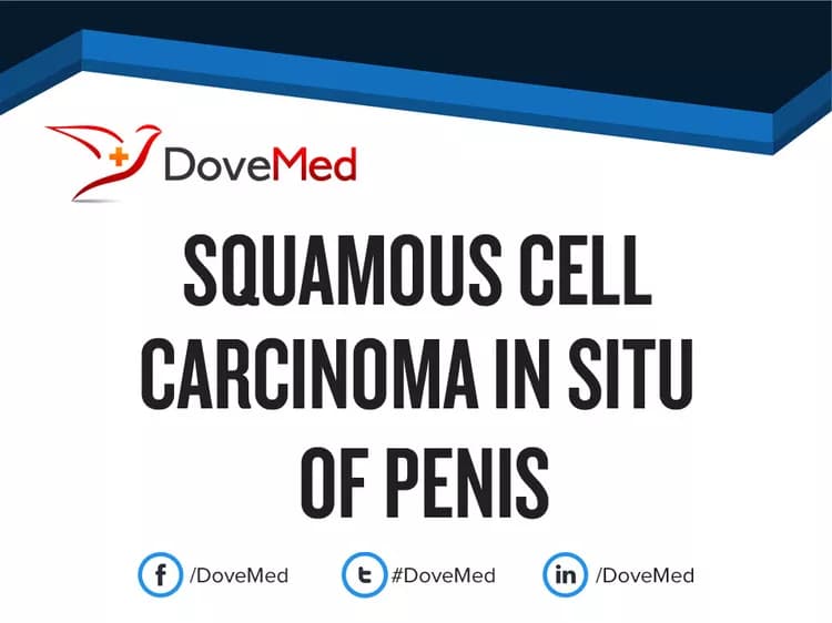 Can you access healthcare professionals in your community to manage Squamous Cell Carcinoma In Situ of Vulva?