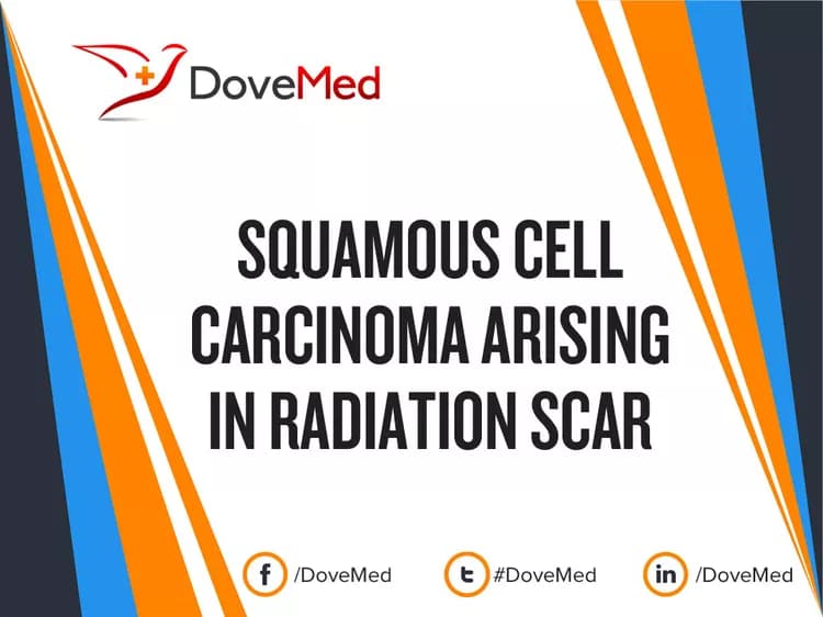 Is the cost to manage Squamous Cell Carcinoma arising in Radiation Scar in your community affordable?