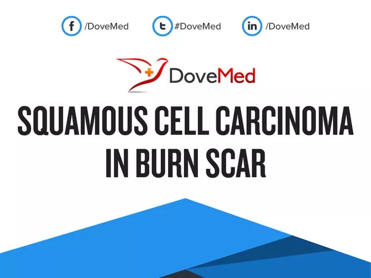 Squamous Cell Carcinoma in Burn Scar