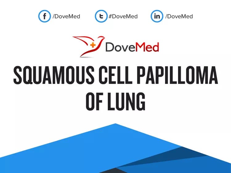 Can you access healthcare professionals in your community to manage Squamous Cell Papilloma of Lung?