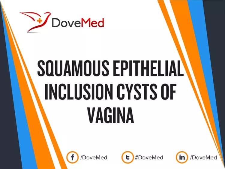 Can you access healthcare professionals in your community to manage Squamous Epithelial Inclusion Cysts of Vagina?