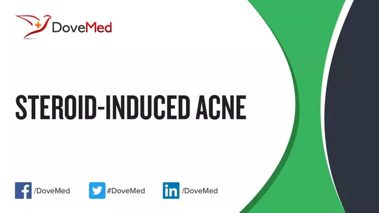 Steroid-Induced Acne