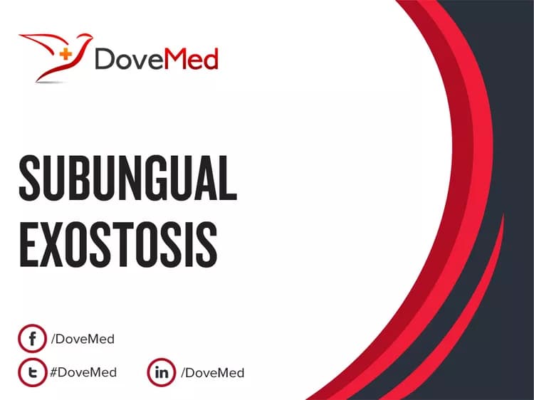 Is the cost to manage Subungual Exostosis in your community affordable?