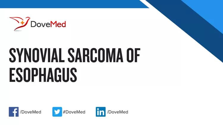 Can you access healthcare professionals in your community to manage Synovial Sarcoma of Esophagus?