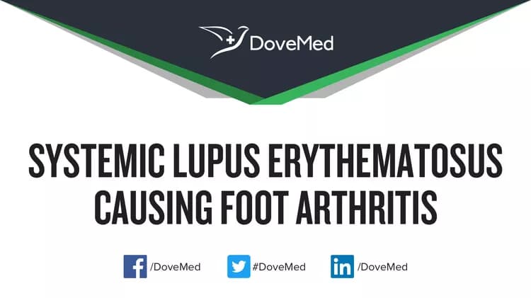 Systemic Lupus Erythematosus causing Ankle Arthritis