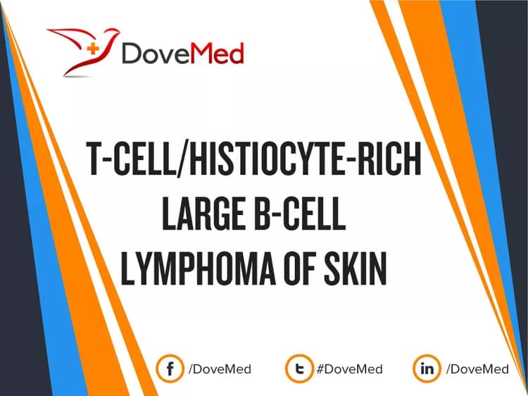 T-Cell/Histiocyte-Rich Large B-Cell Lymphoma of Skin