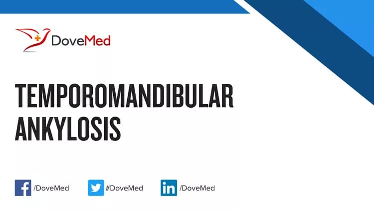Can you access healthcare professionals in your community to manage Temporomandibular Ankylosis?