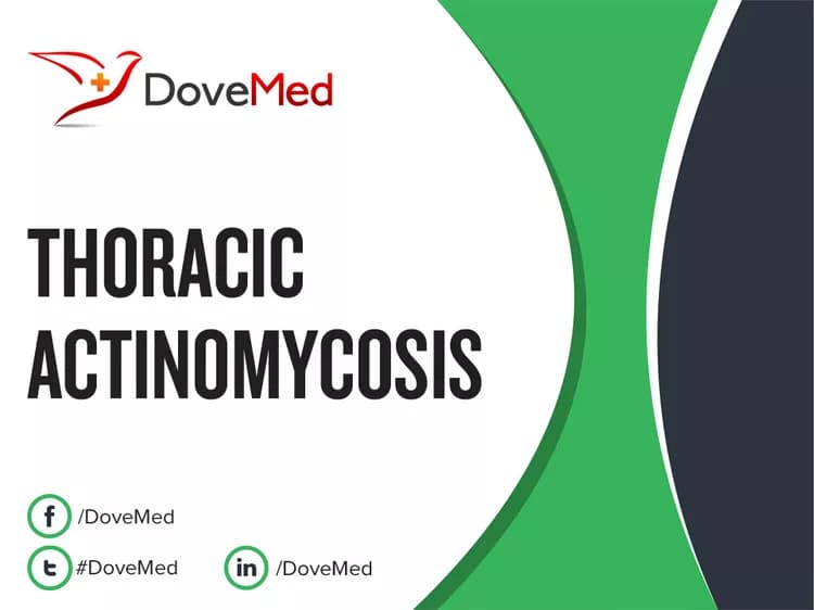 Can you access healthcare professionals in your community to manage Thoracic Actinomycosis?